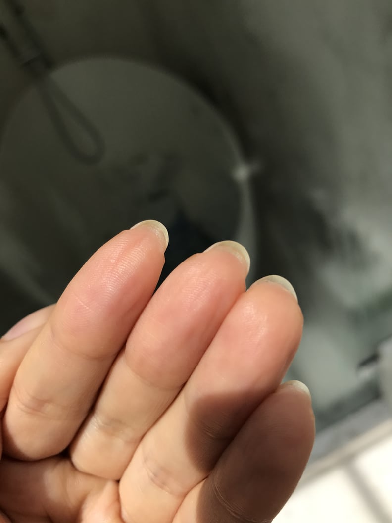 Why You Have Skin Growing Under Your Nails, According to Experts