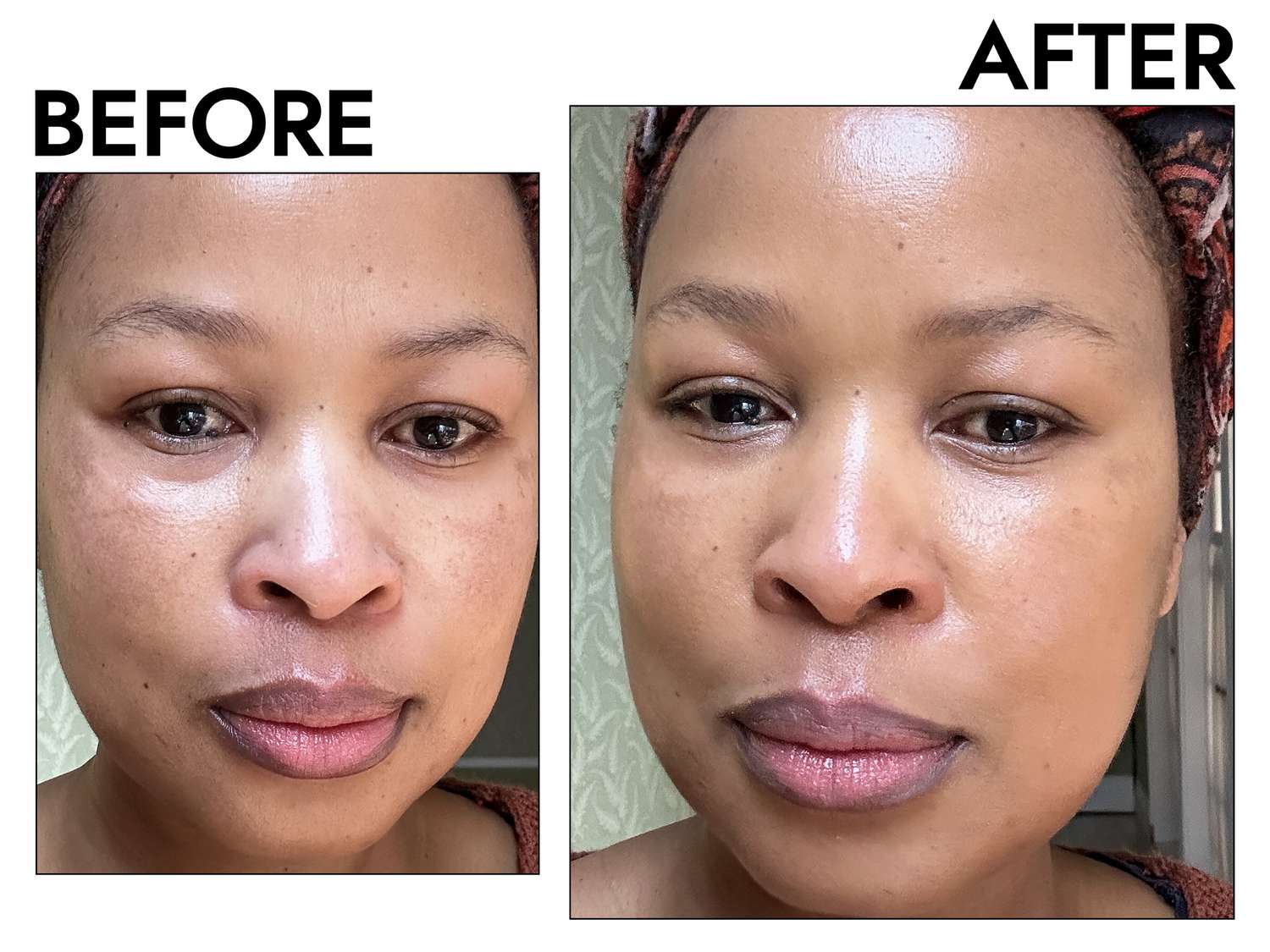 Before and after Using Radiance True Complexion