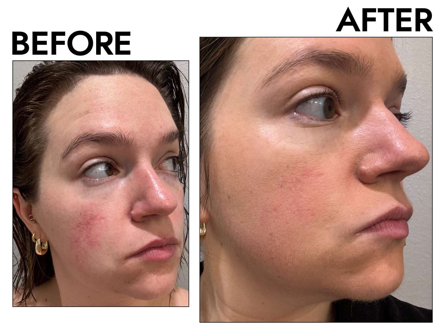 Before and After using Pacifica Kind Tint Tinted Serum