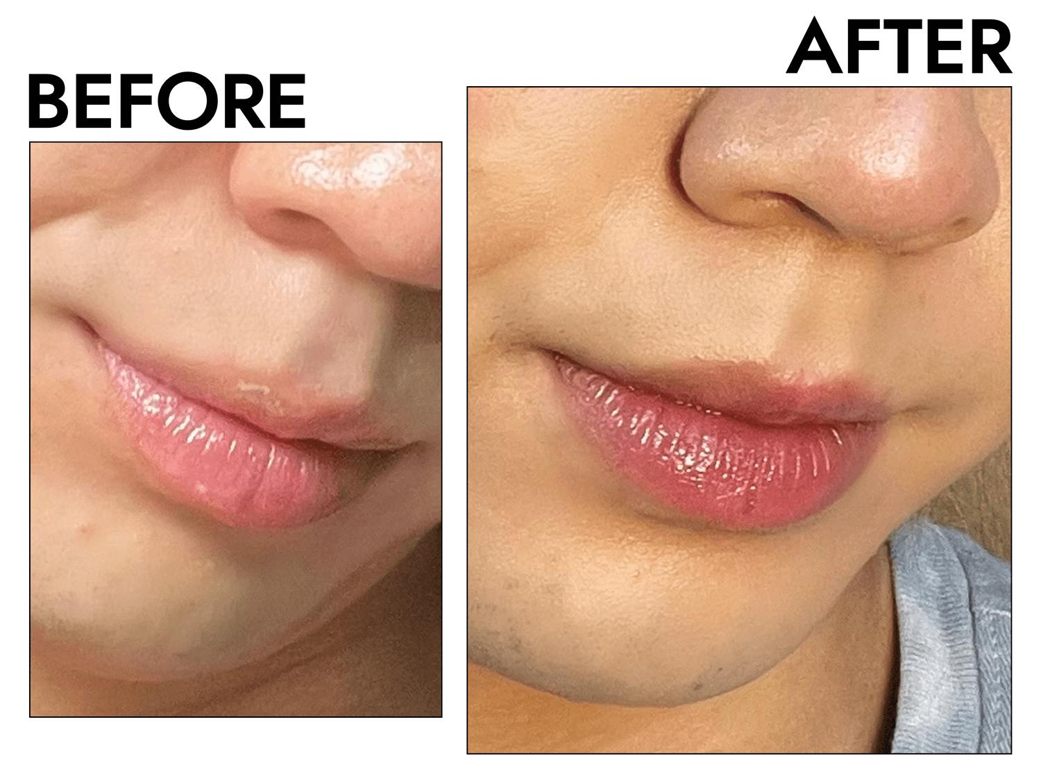 Close-up of Byrdie writer Derek Deng's lips before and after applying The Inkey List's Tripeptide Plumping lip balm